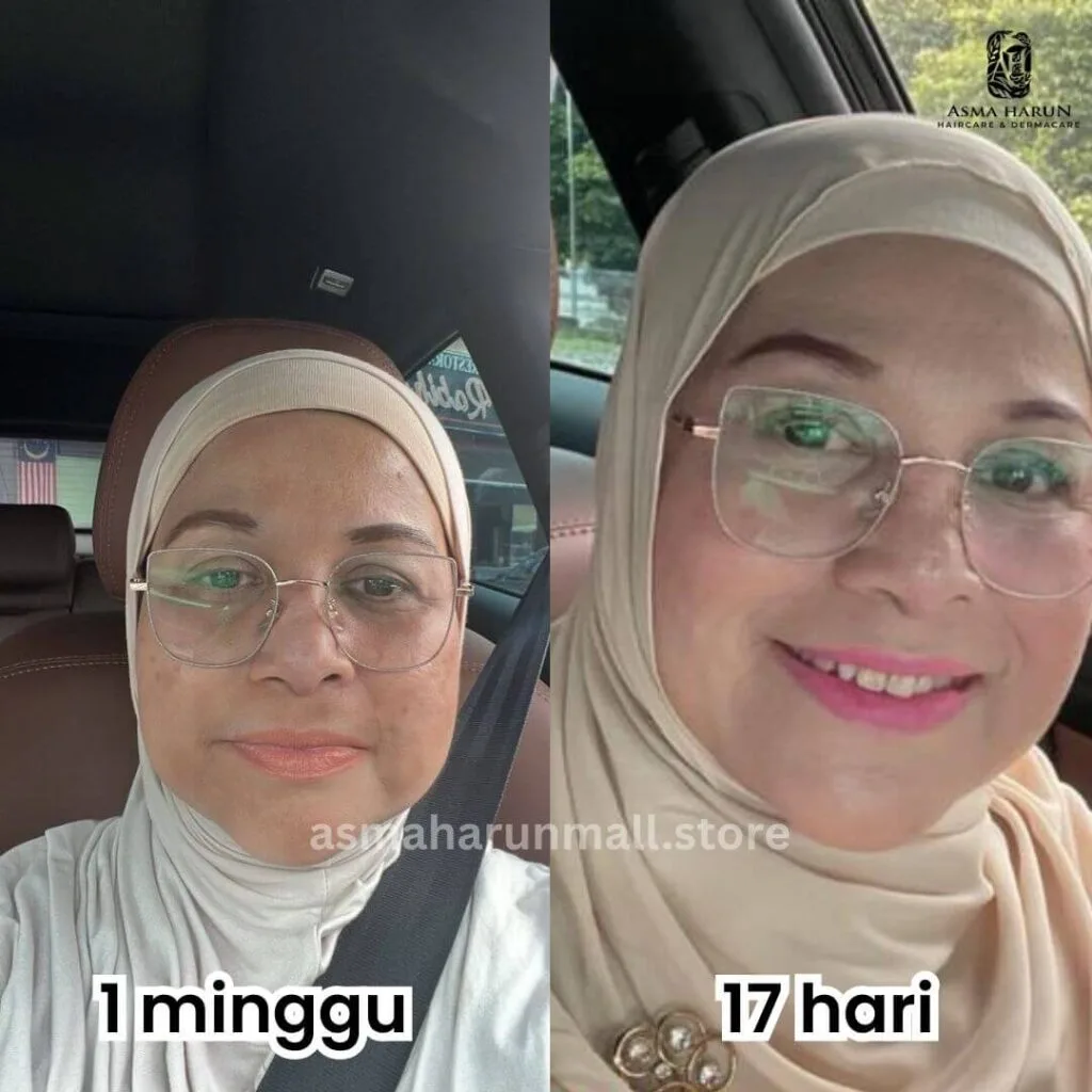 Muka tak berminyak Asma' Harun