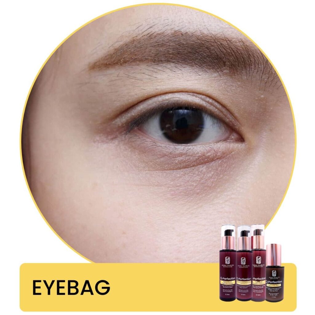 eyebag ASma Harun