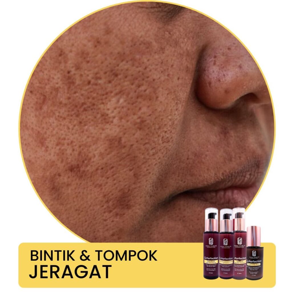 bintik tompok jeragat Asma Harun