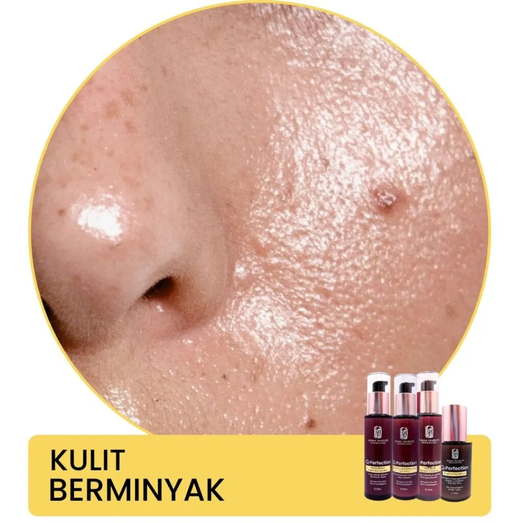 Kulit beminyak Asma Harun